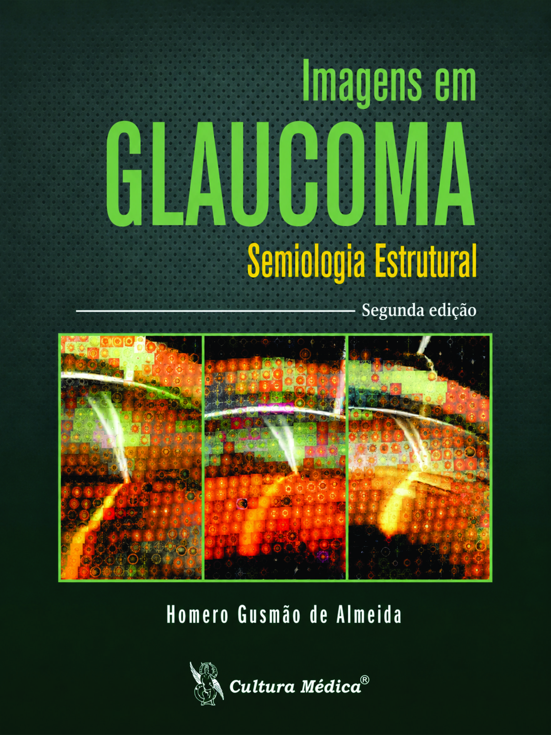 Imagens em Glaucoma - Semiologia Estrutural – 2. Edição