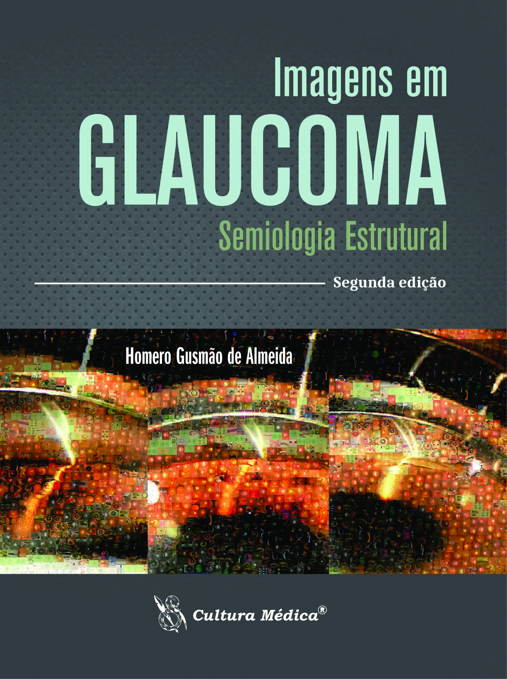 Imagens em Glaucoma - Semiologia Estrutural – 2. Edição