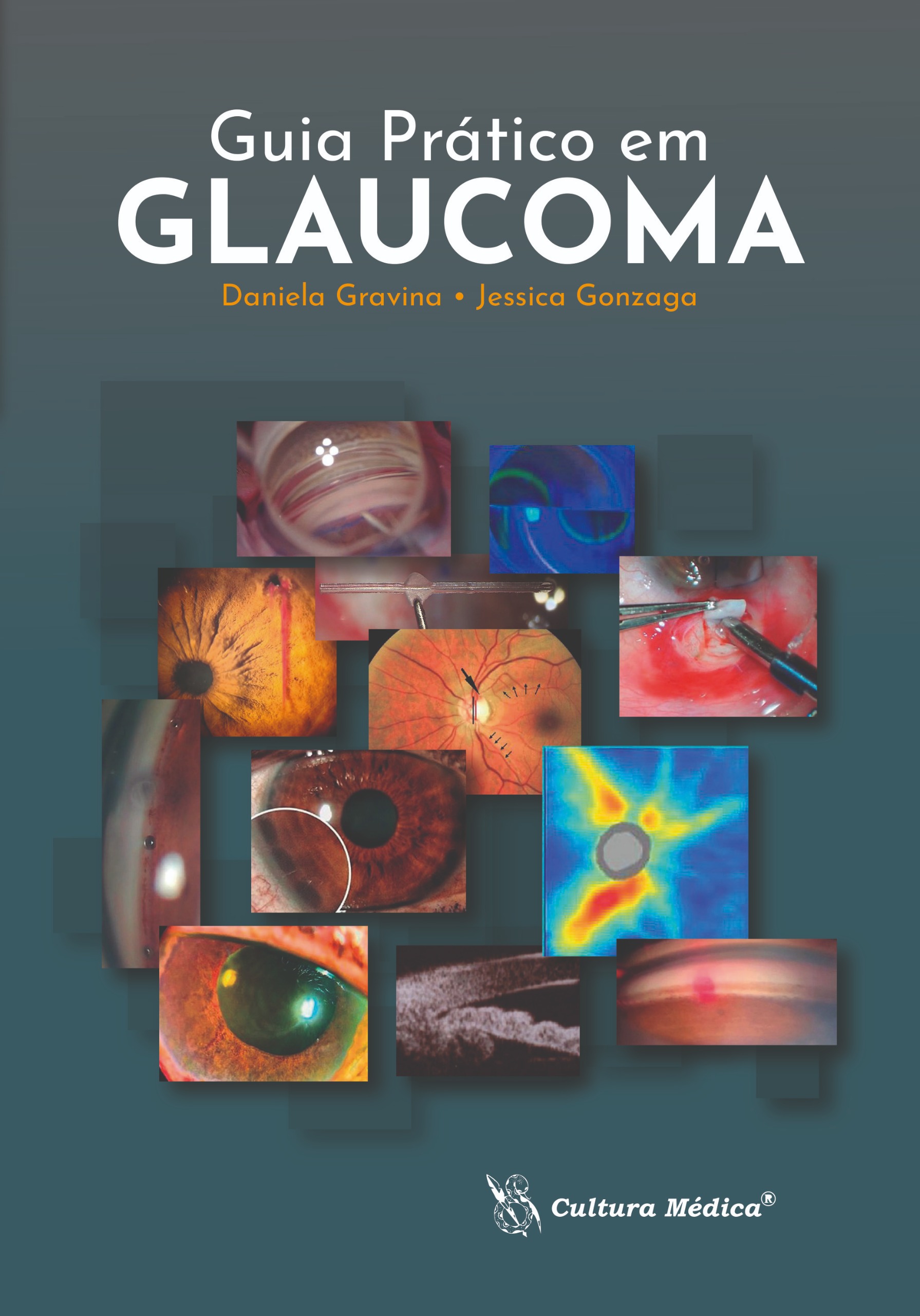 Guia Prático em GLAUCOMA