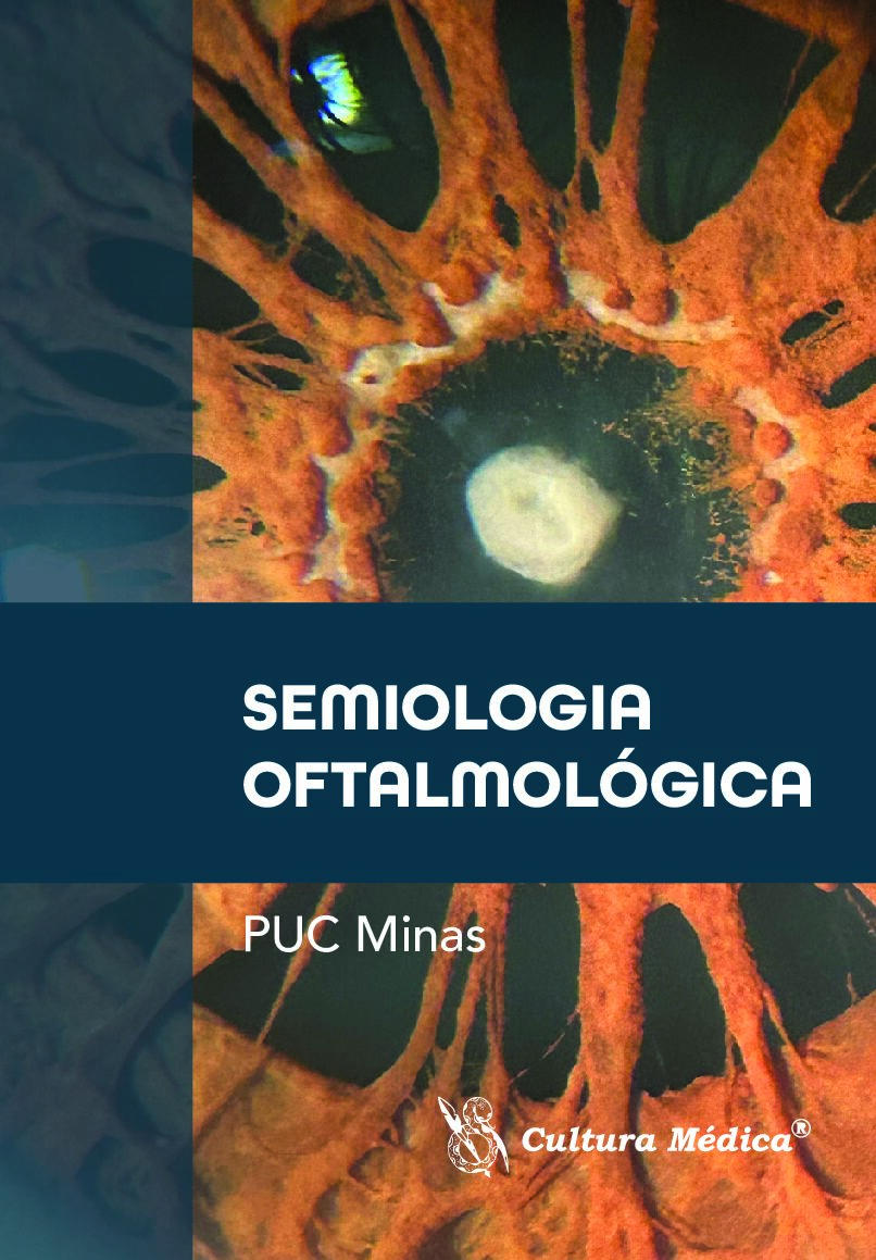 Semiologia Oftalmológica PUC Minas
