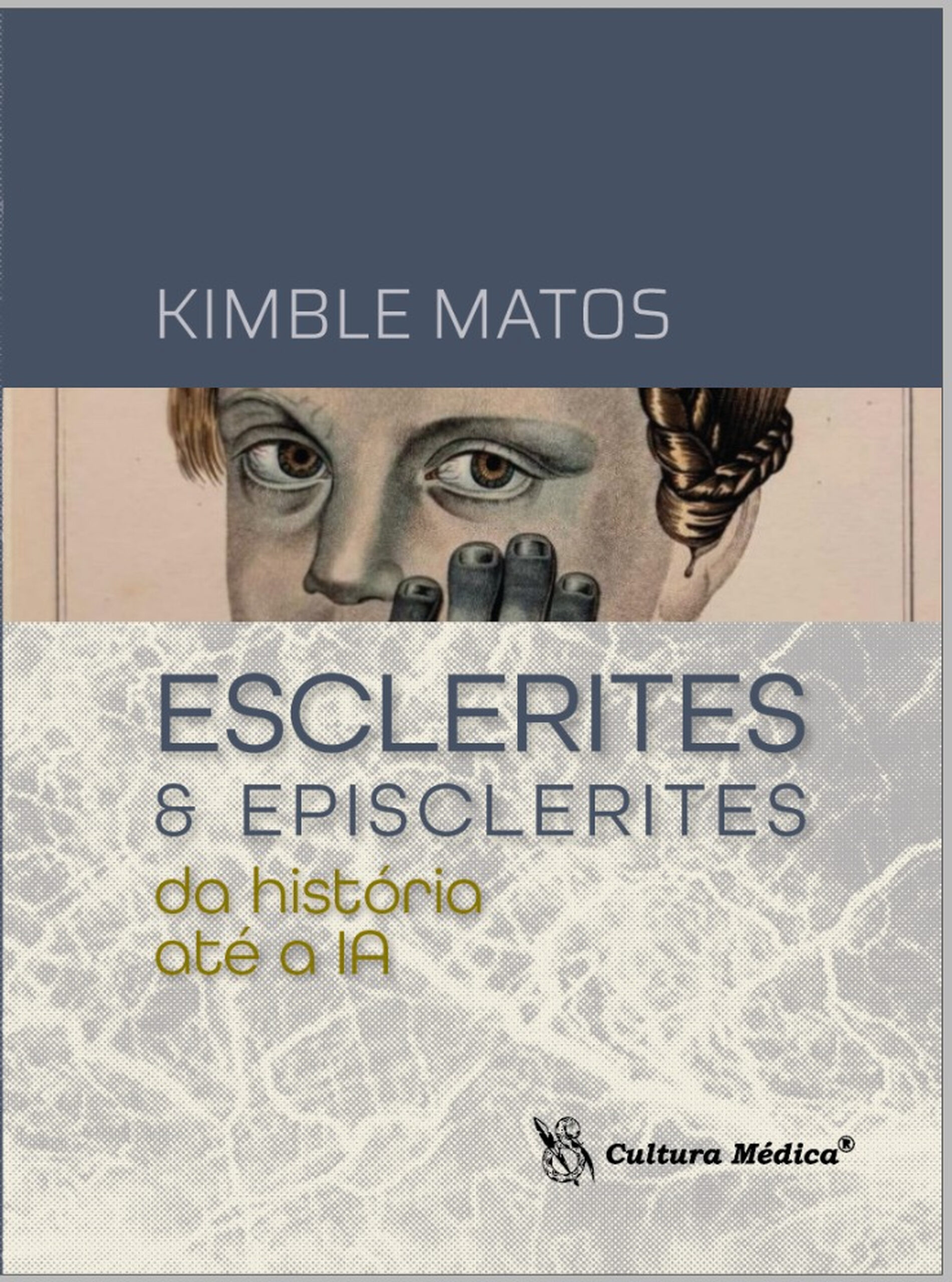 Esclerites & Episclerites - da história até a IA